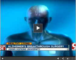 johns-hopkins-alzheimers-video