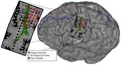 hopkins-mind-controlled-arm-photo