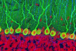 Old people can produce as many new brain cells as teenagers New Scientist