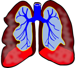 Lungs 39981 640