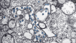 Md. biotech companies are working on new COVID-19 vaccines, tests – Baltimore Business Journal