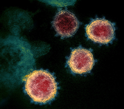 Novel Coronavirus SARS CoV 2 Coronavirus disease 2019 Wikipedia