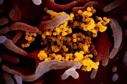 GSK AstraZeneca in talks for joint U K COVID 19 diagnostics project Bloomberg FierceBiotech