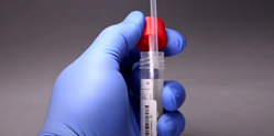 Charlottesville company develops test to predict most severe cases of COVID 19